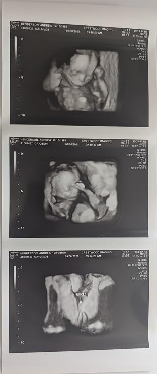 Prank 3D Customized Fake Ultrasound Strip of 3 Photos